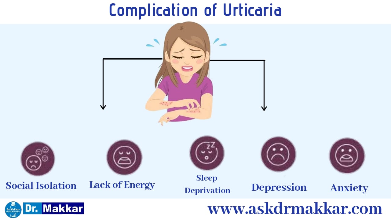 Complication of urticaria